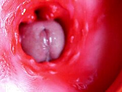 मैसिव लंड होल भरता है