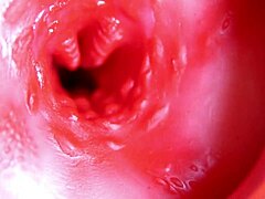 मैसिव लंड होल भरता है