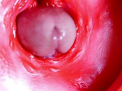 मैसिव लंड होल भरता है