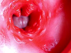 मैसिव लंड होल भरता है